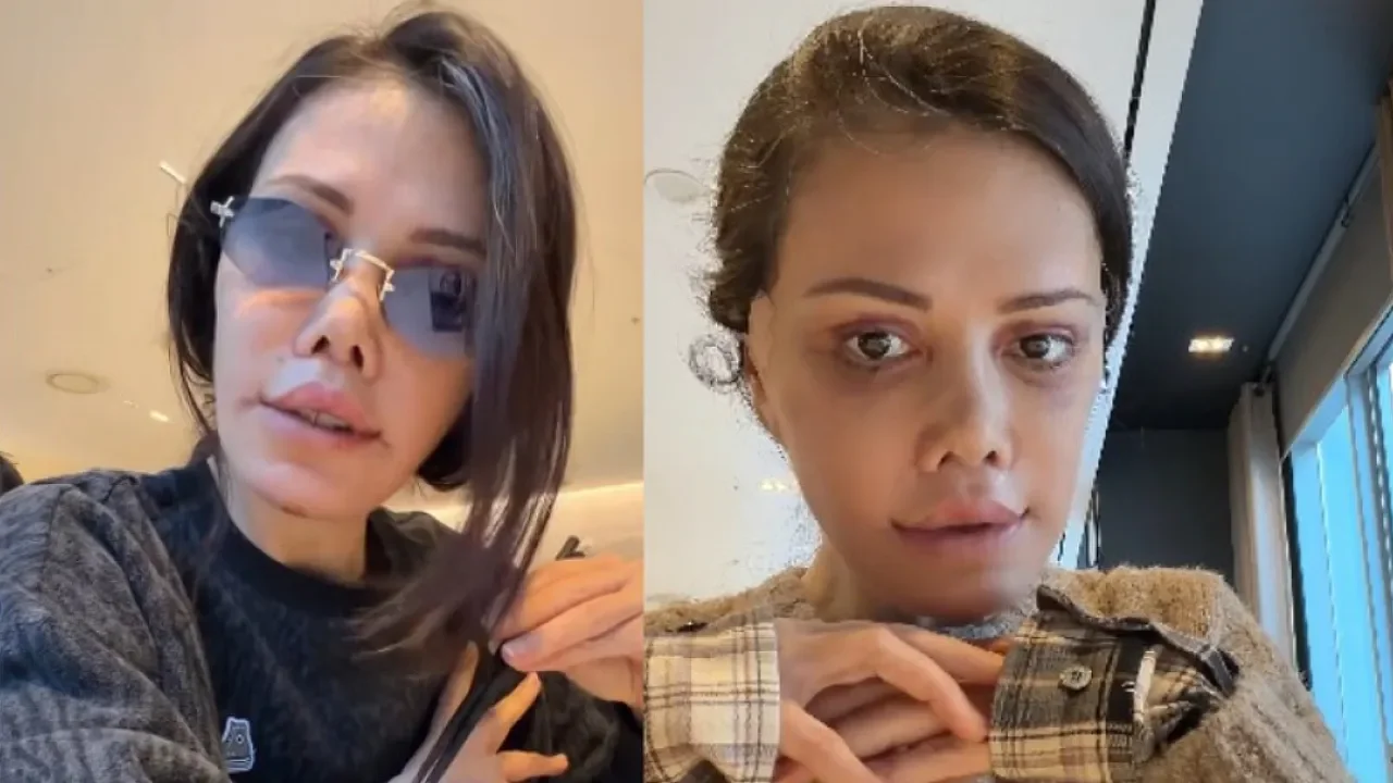 Didem Ceran'dan Dikkat Çeken 'Yüz Nakli' Çıkışı: "Para İçin Referans Olmam"